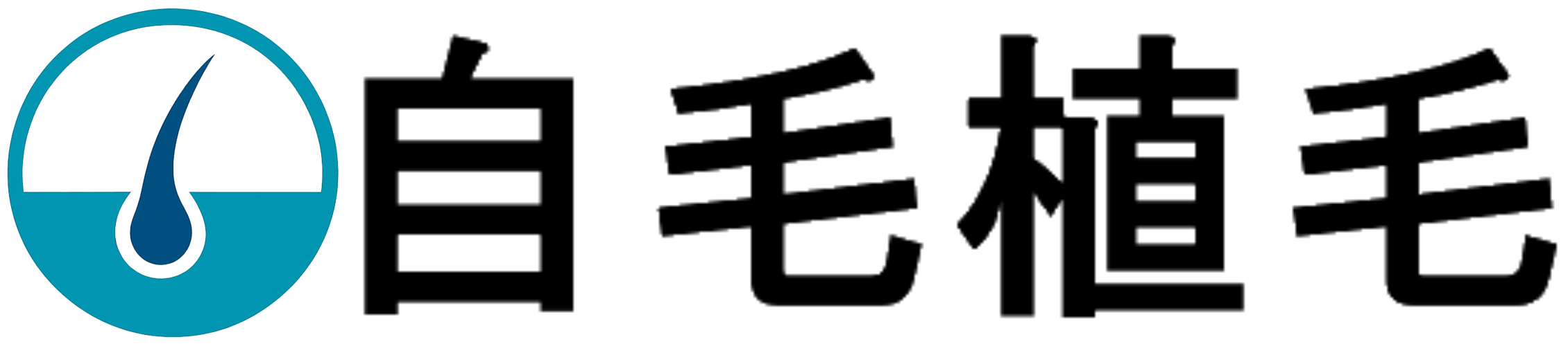 自毛植毛おすすめ