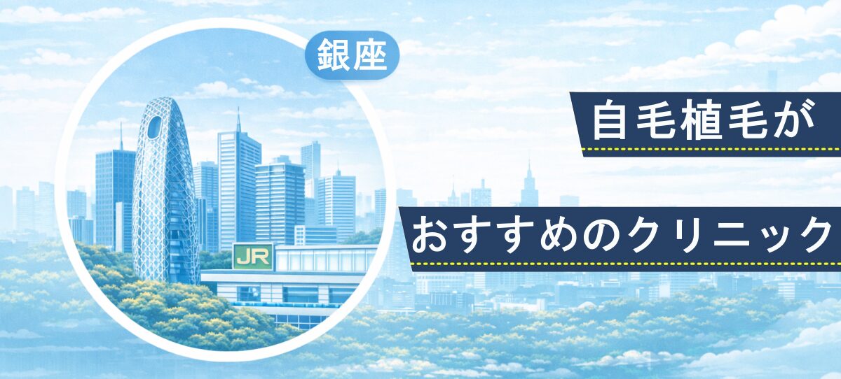 銀座エリアの高層ビルと銀座駅をモチーフにしたイラスト。自毛植毛クリニック比較記事のファーストビュー画像。