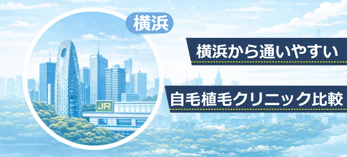 横浜エリアの高層ビルとJR新宿駅をモチーフにしたイラスト。自毛植毛クリニック比較記事のファーストビュー画像。
