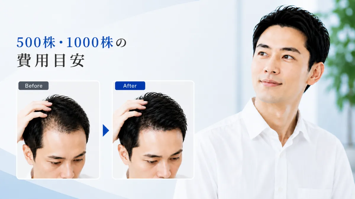 自毛植毛500株・1000株の費用目安とビフォーアフターイメージ